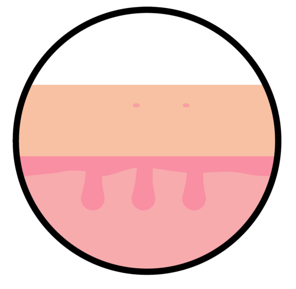 Risultati epilazione